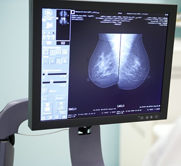 The Business Magazine article image for: AI Breast Screening needs stronger evidence before it is safe for clinical use - says IT Chartered Institute